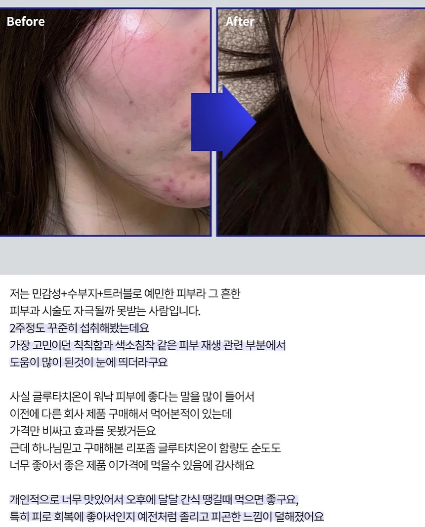 두바이 산도 피스타치오 13