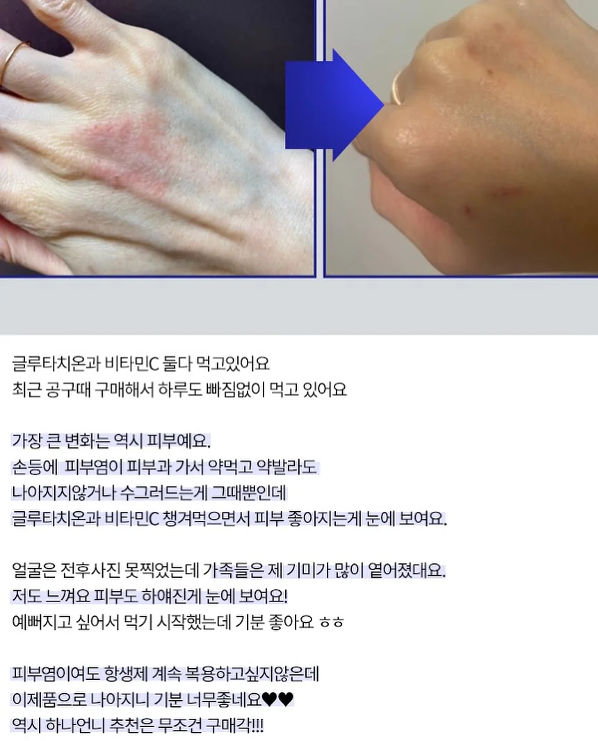 두바이 산도 피스타치오 15