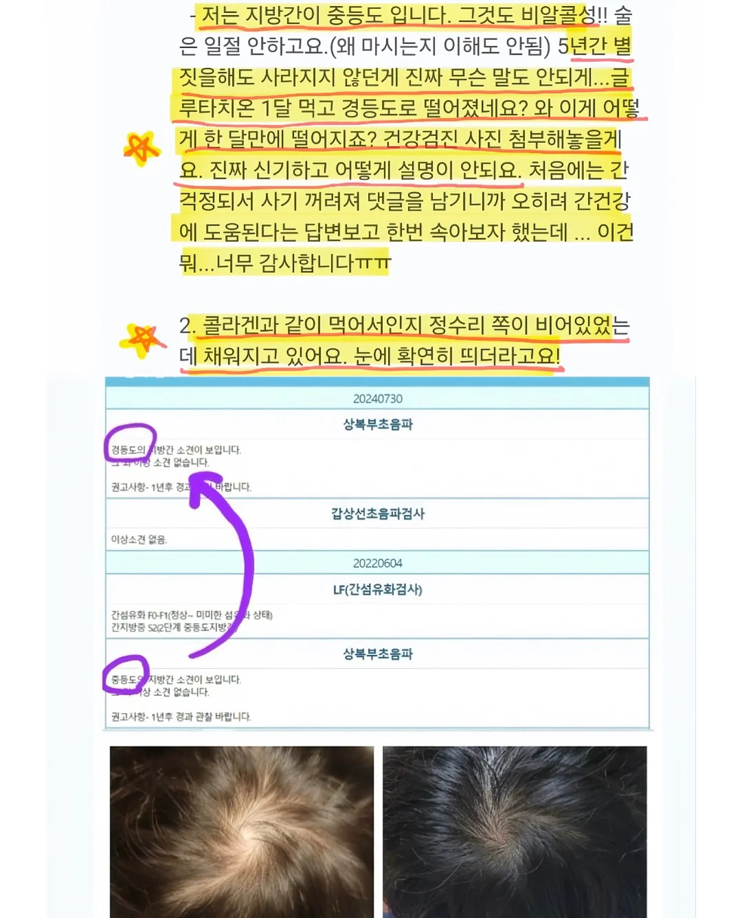 두바이 산도 피스타치오 4