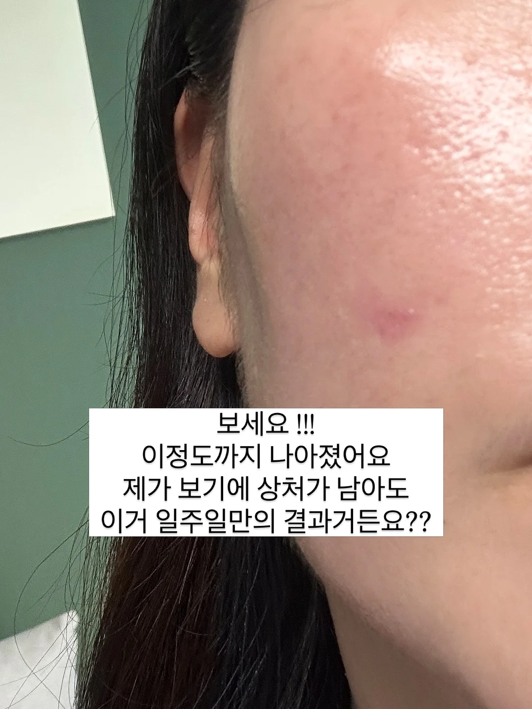 아이스커피 5