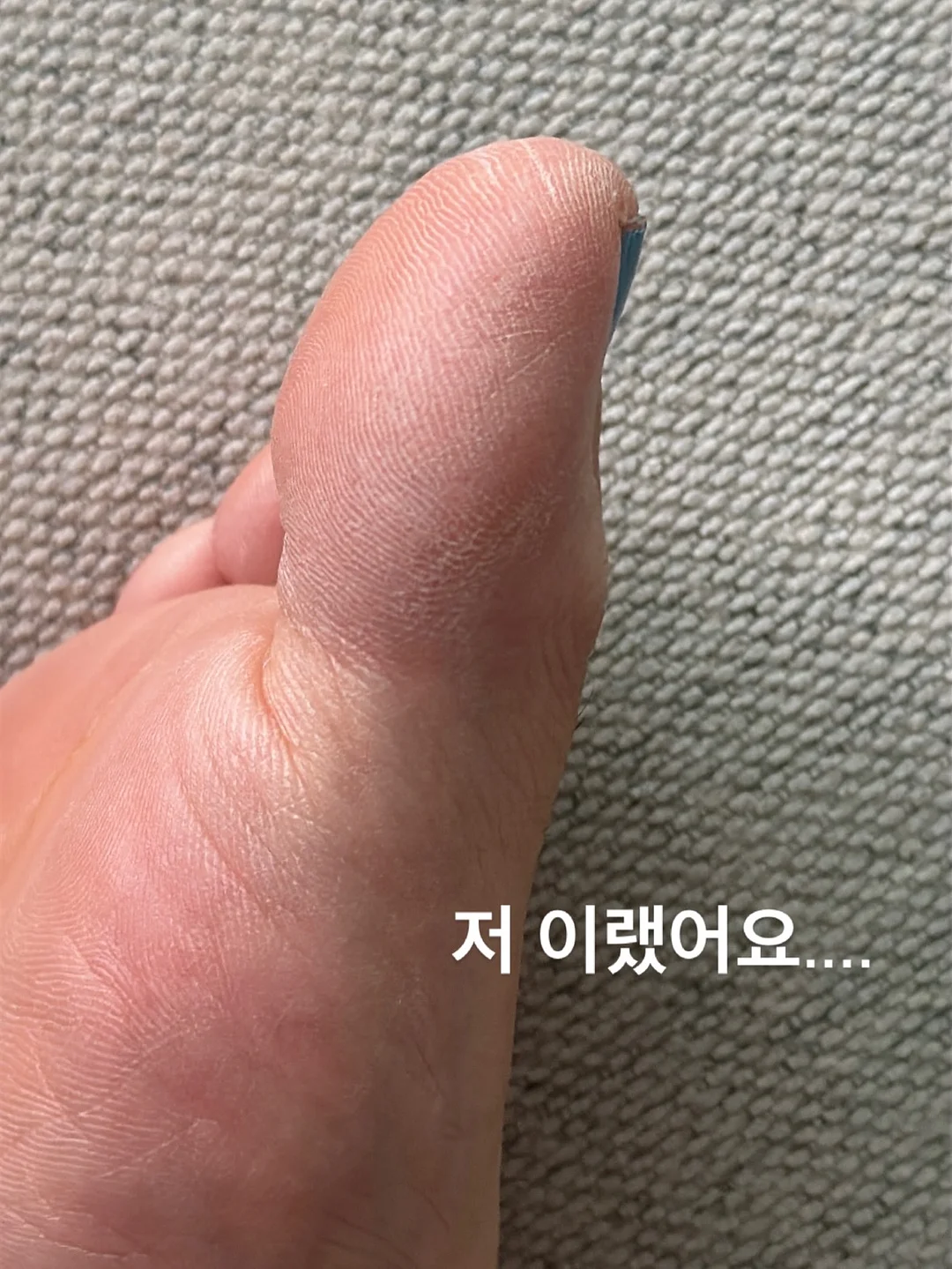팽이버섯 치킨 2