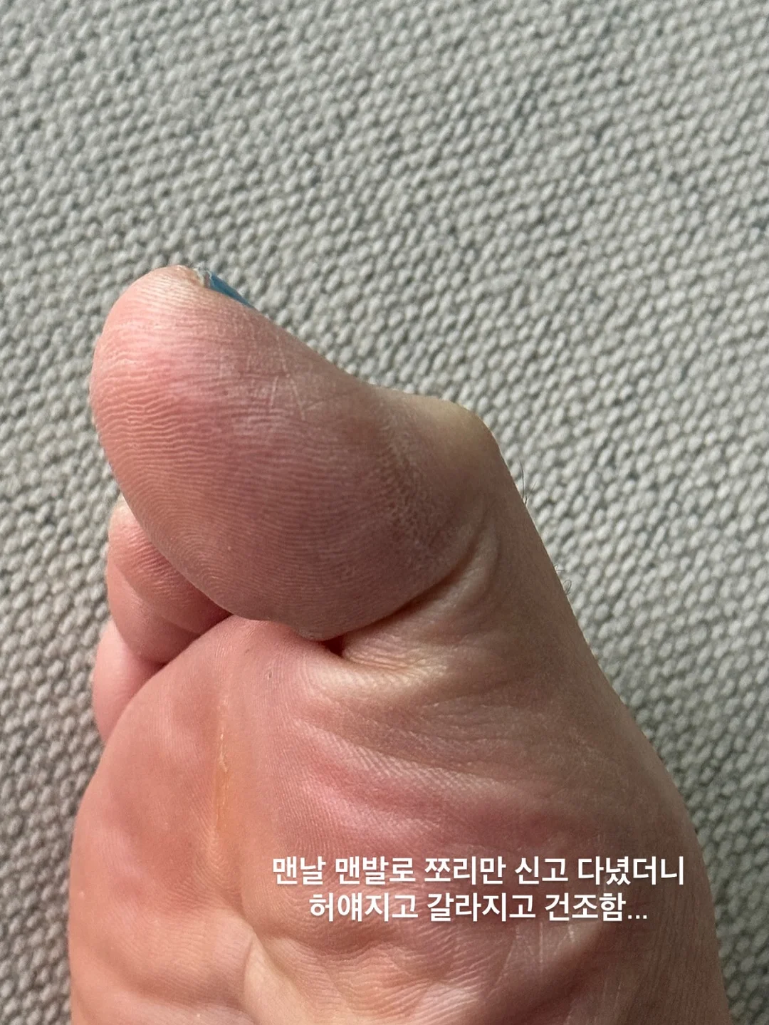 팽이버섯 치킨 3