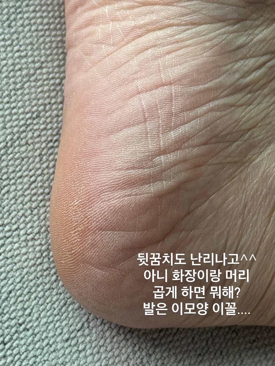 팽이버섯 치킨 4