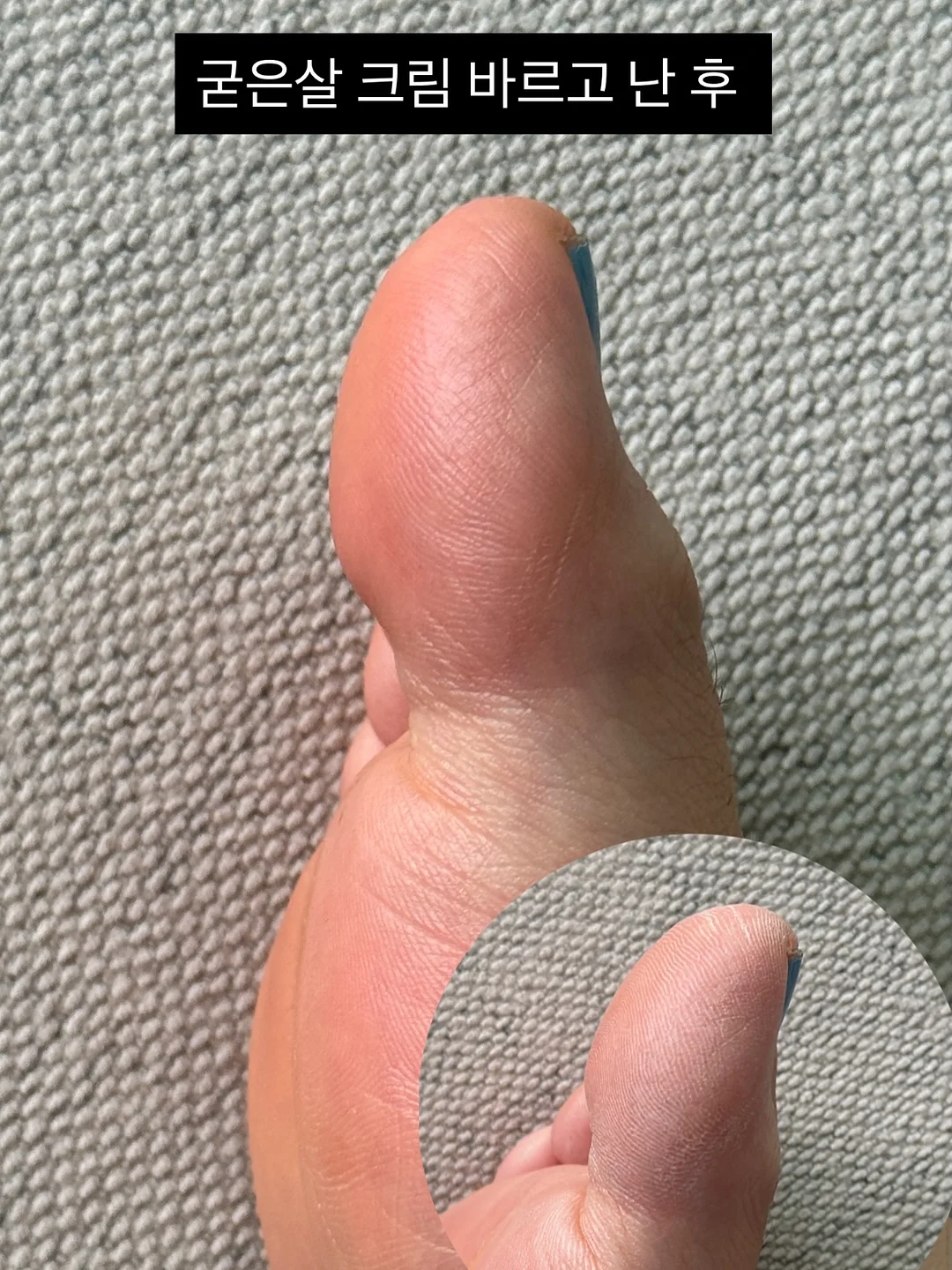 팽이버섯 치킨 6
