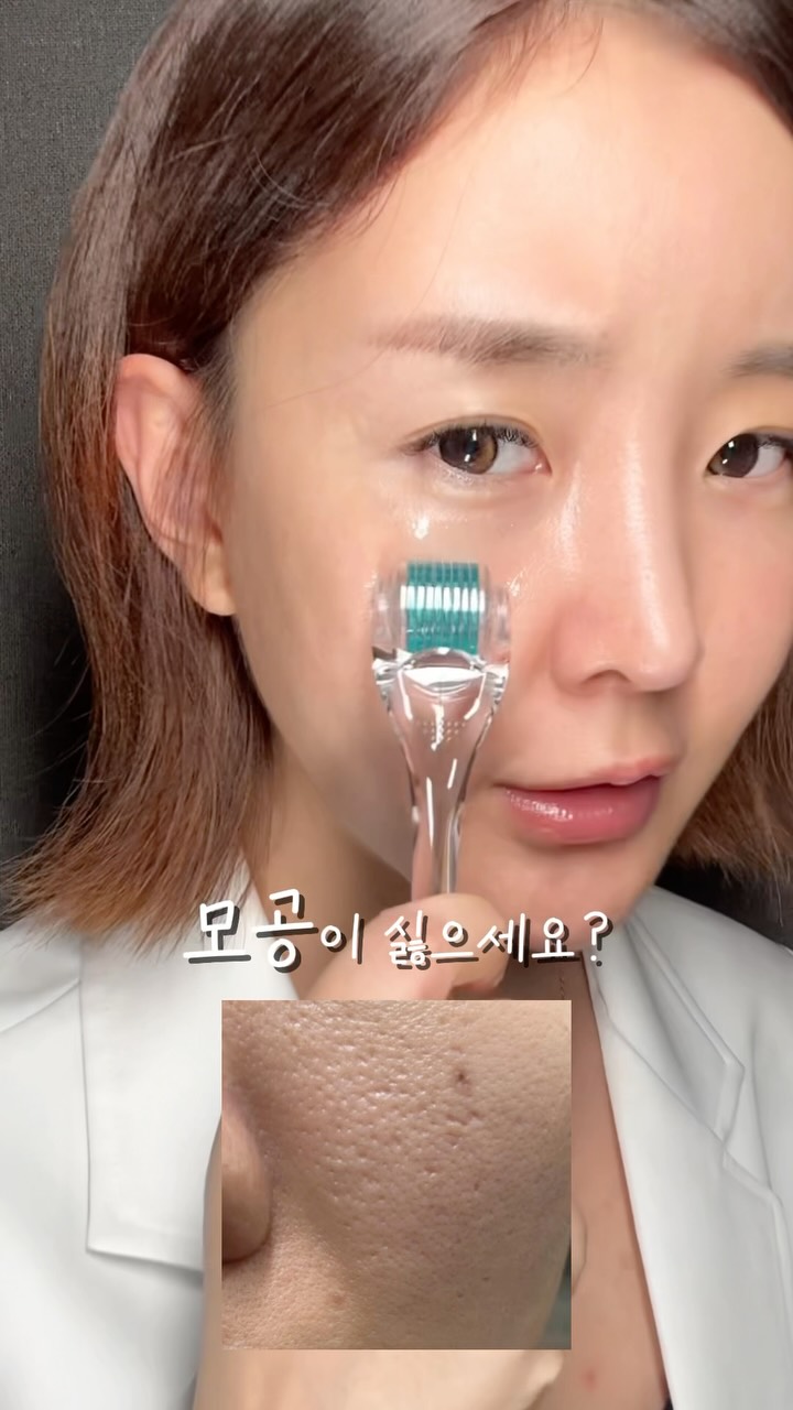 고무 마감재