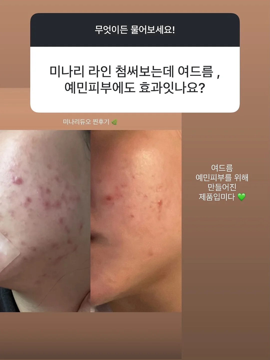 제주항공 면접 기출문제 14