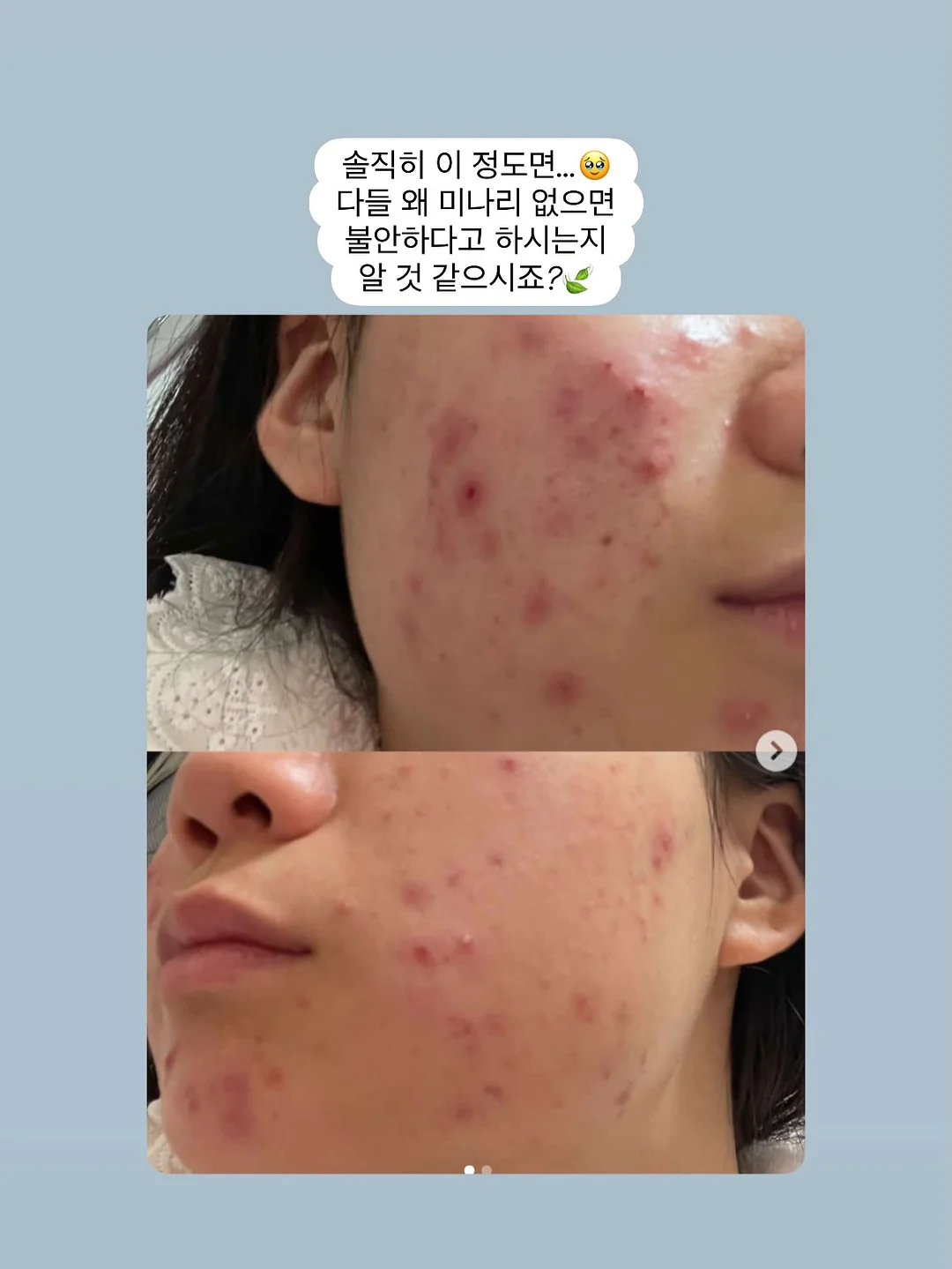 제주항공 면접 기출문제 3