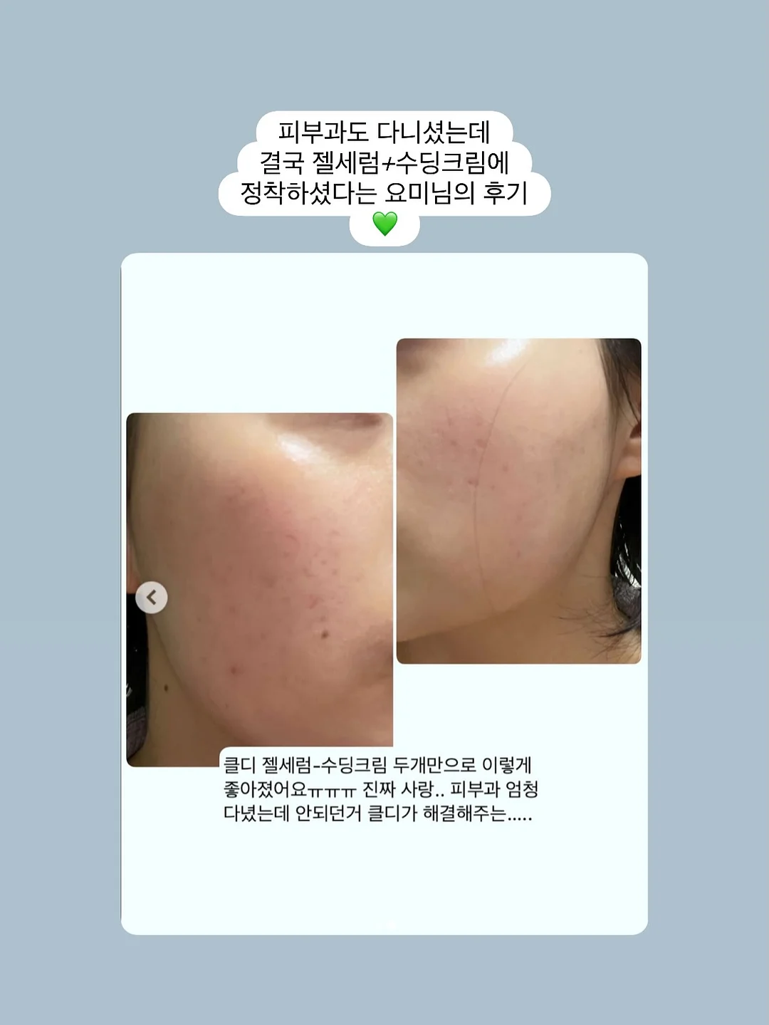 제주항공 면접 기출문제 4
