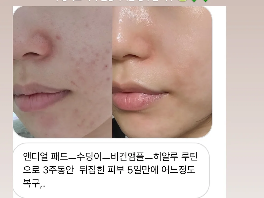 부의 자율주행 4
