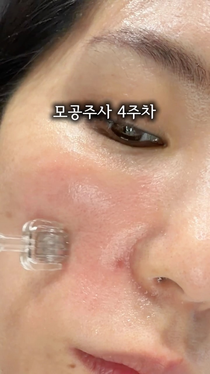 올라잇 그린 / 블루