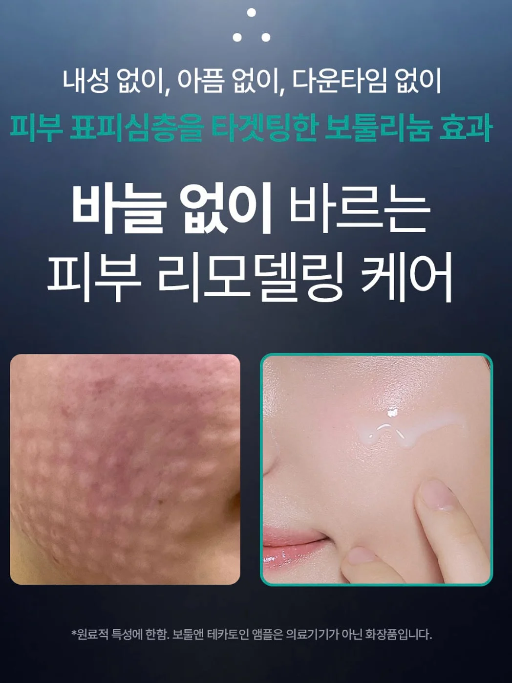 아오스타 여름 의류 4