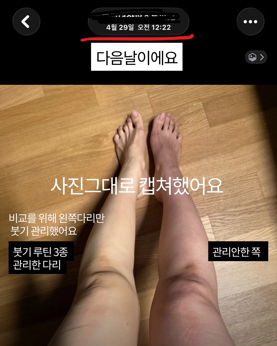 드라이샴푸 4