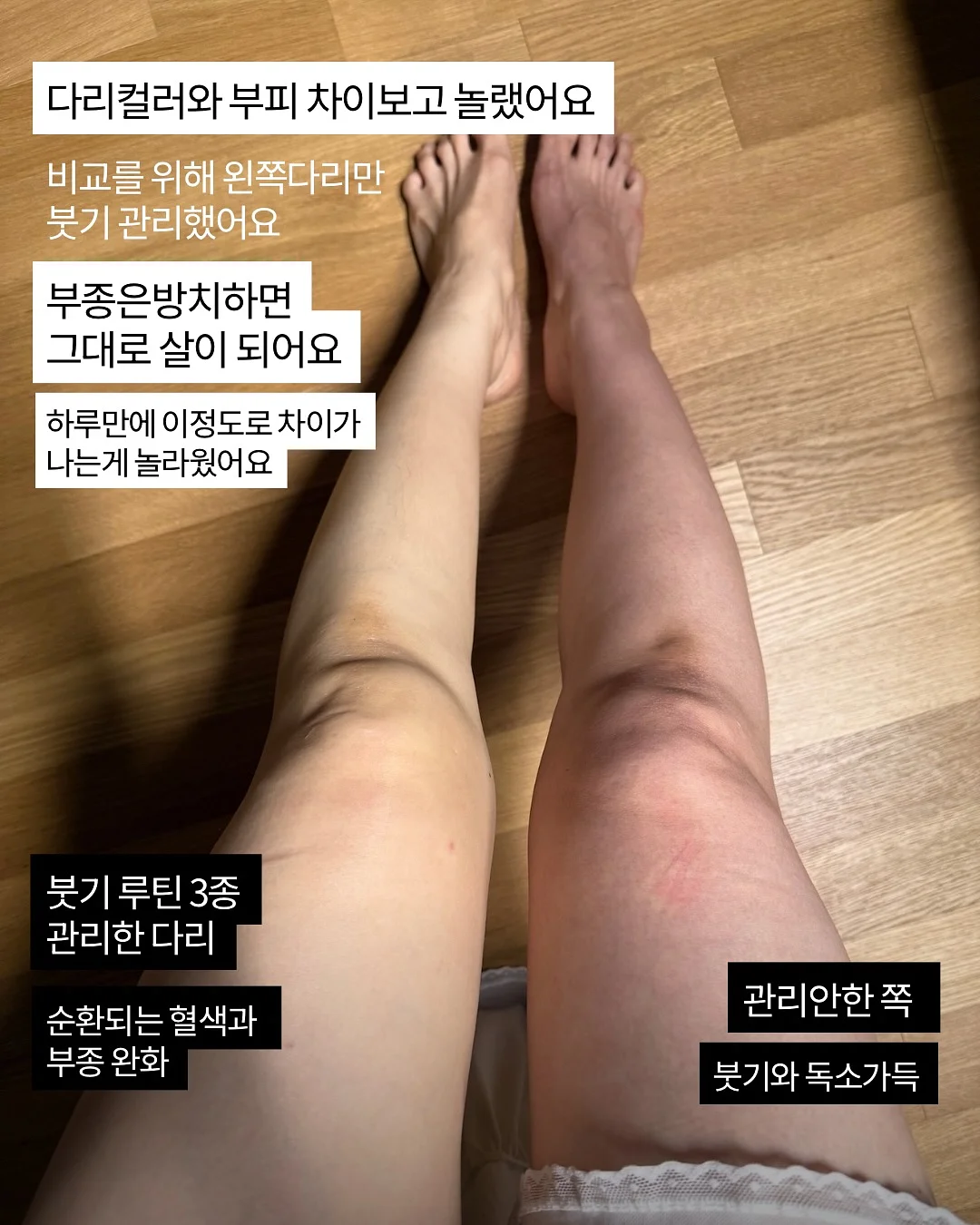 드라이샴푸 5