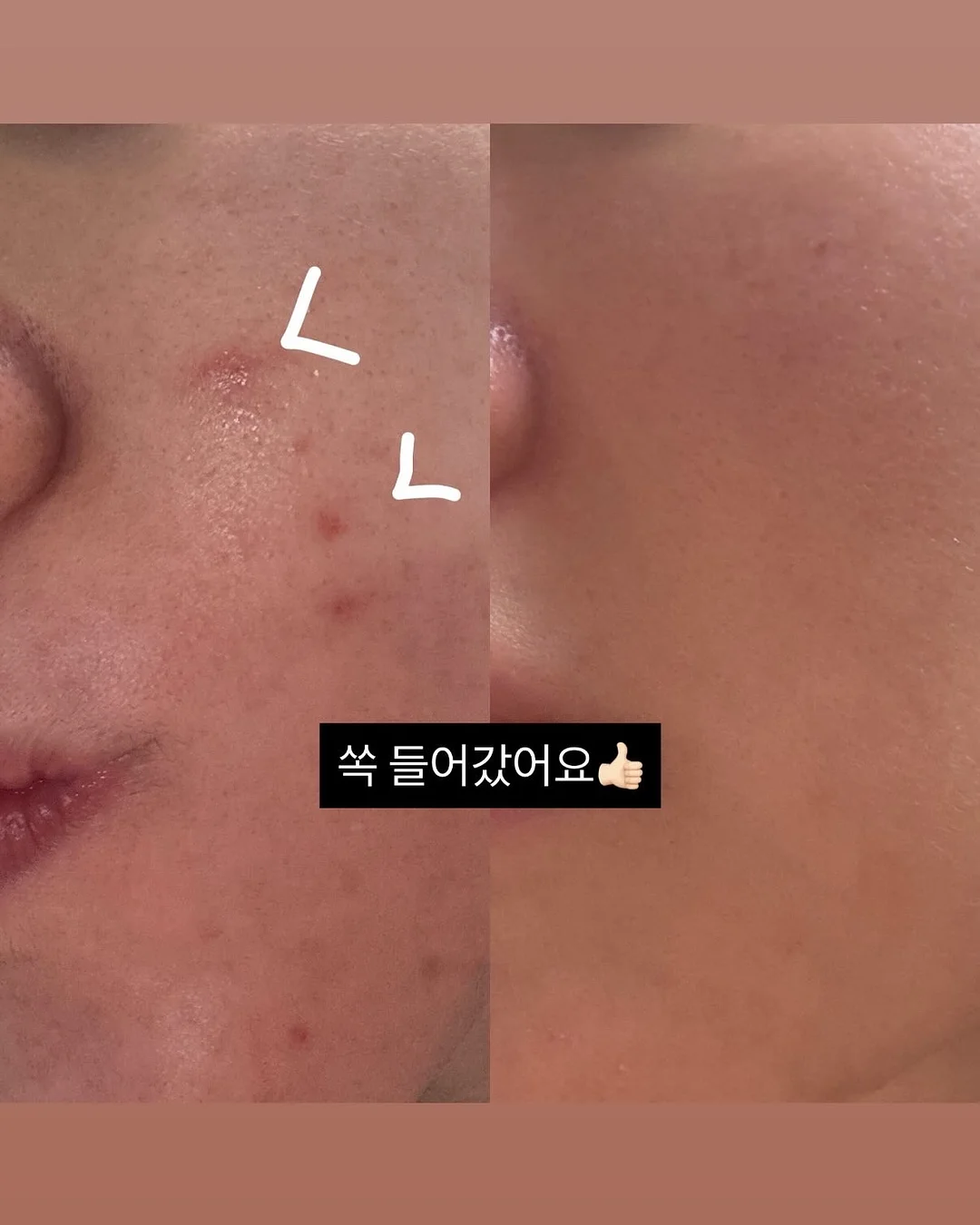 아기 머리핀 11