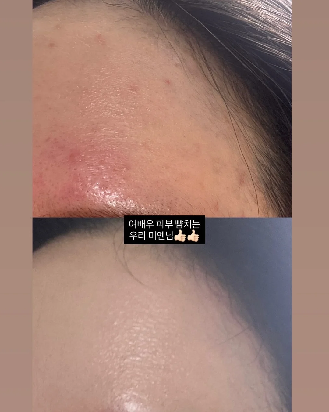 아기 머리핀 12