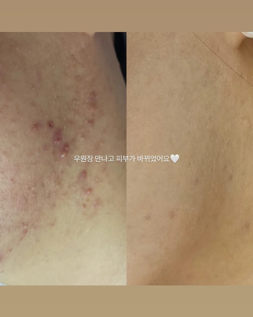 아기 머리핀 14