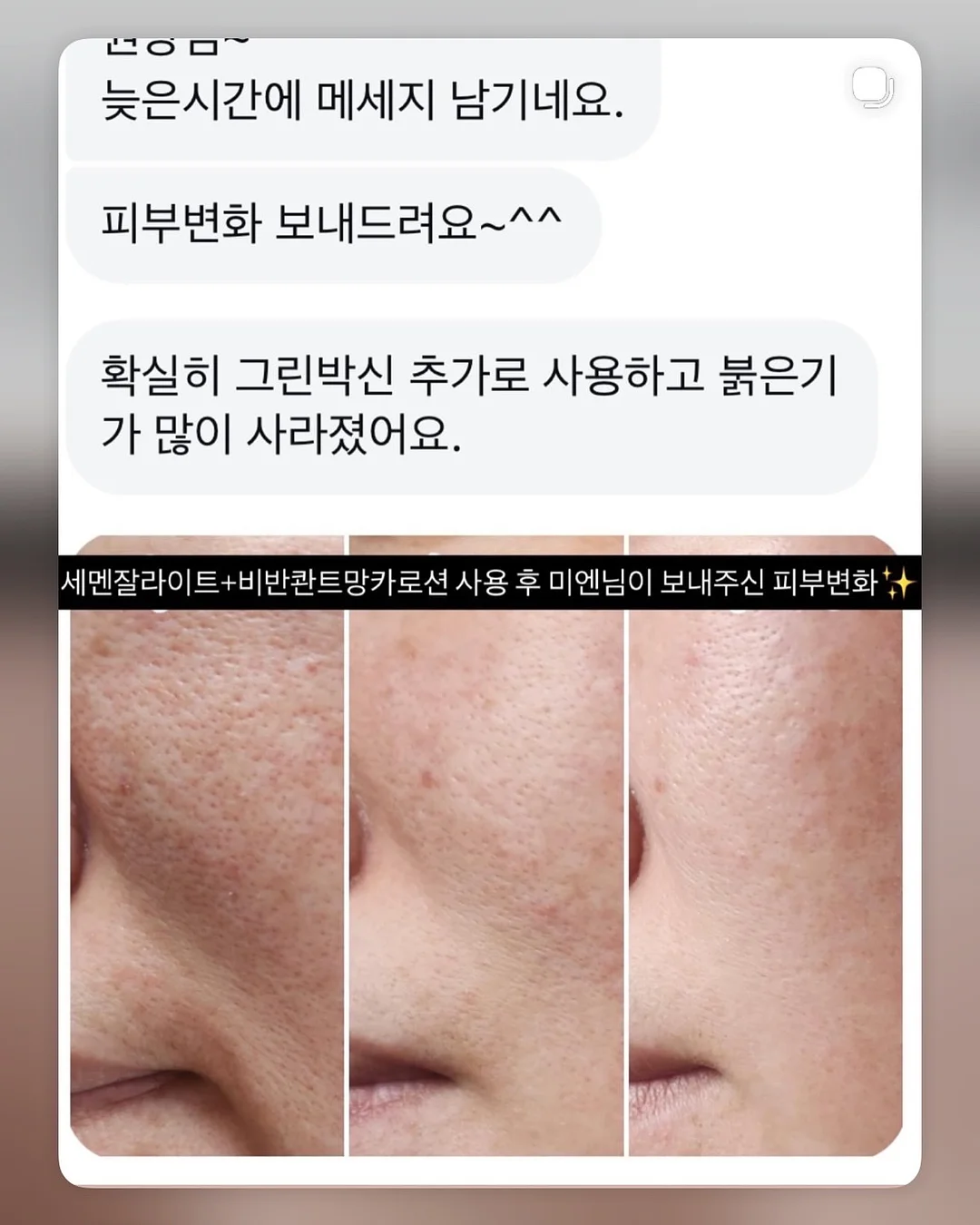 아기 머리핀 10