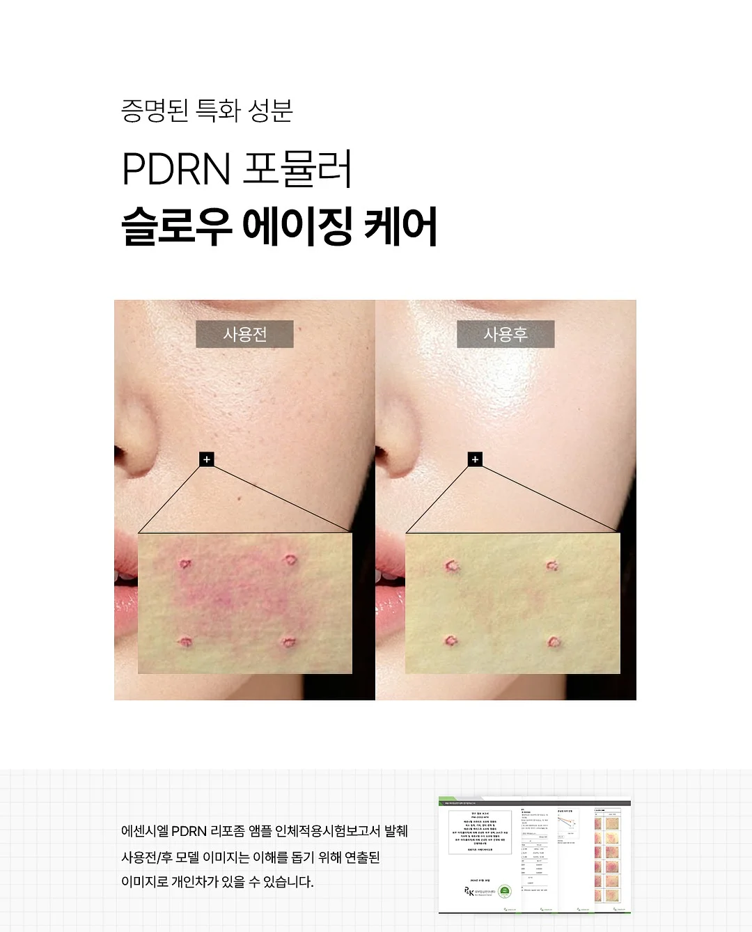 피코베리 클립매트 15