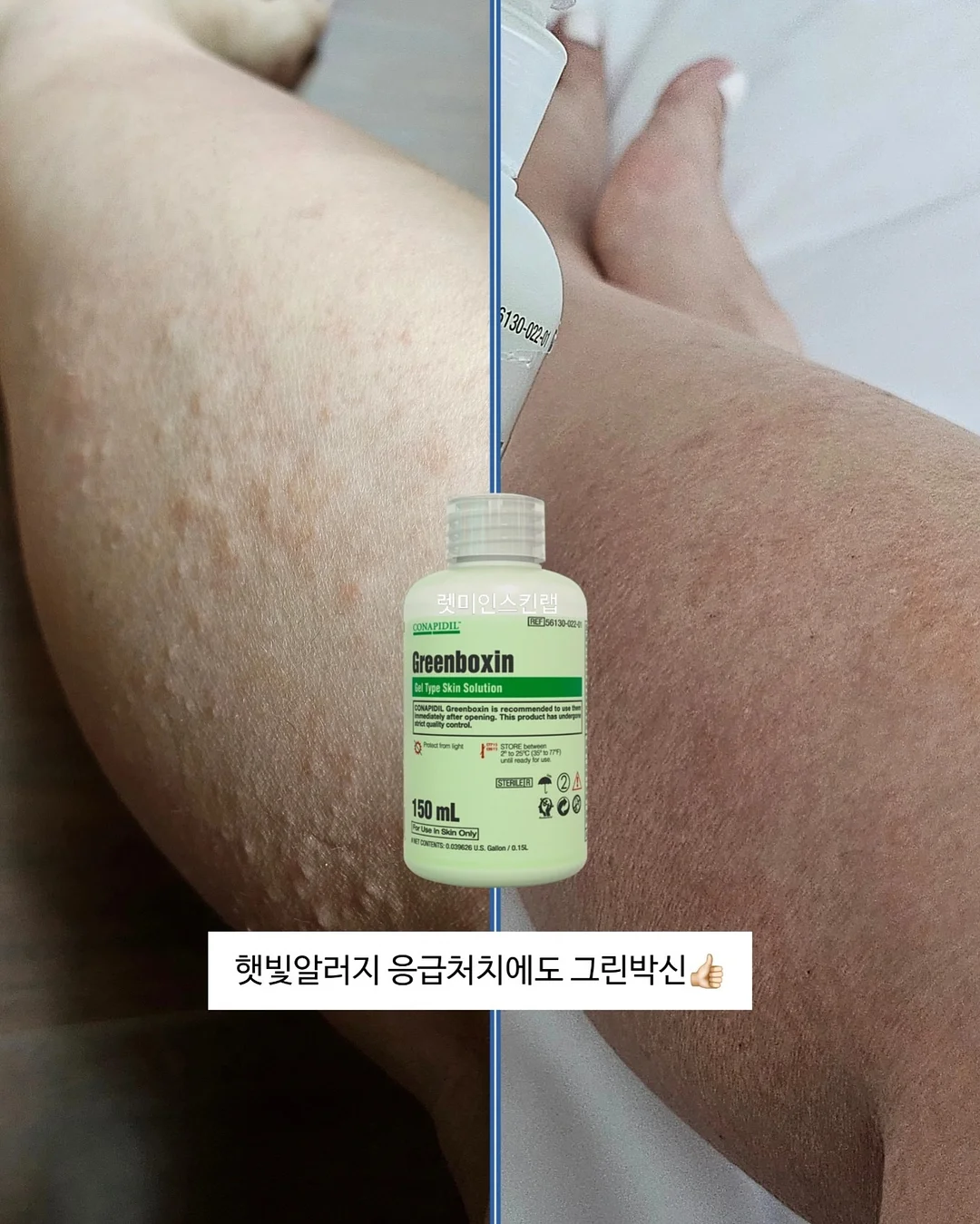 프로젝트 라이프 : 1:1 자기이해 워크숍 + 코칭 패키지 8