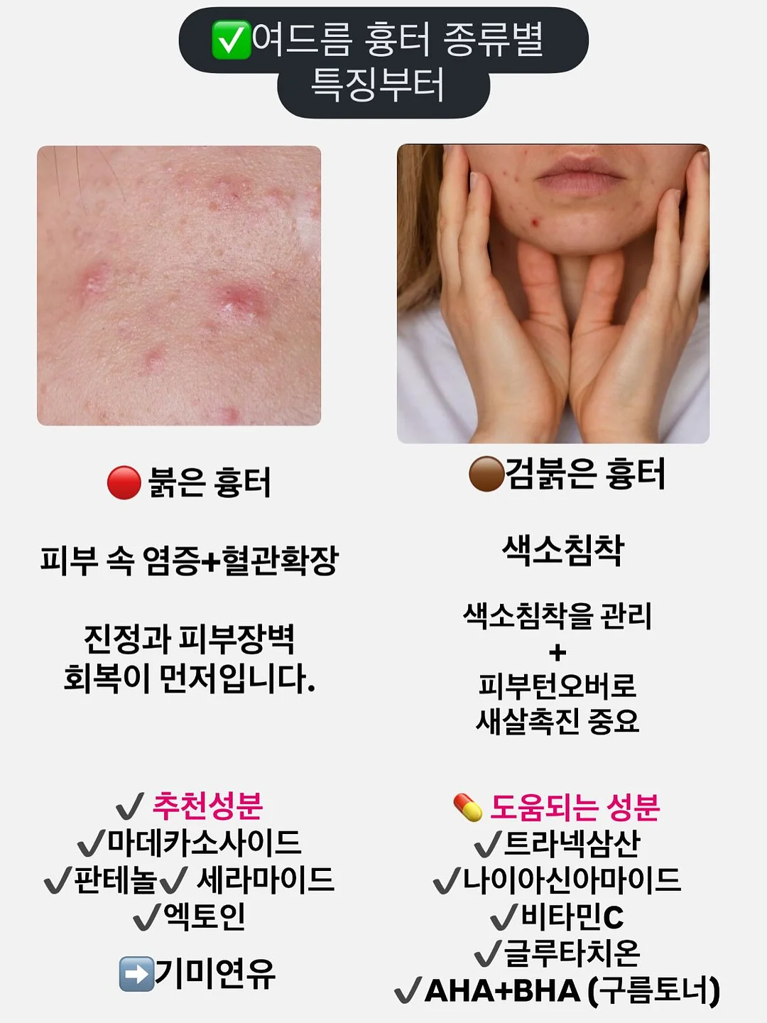 코토나 수건 세트 4