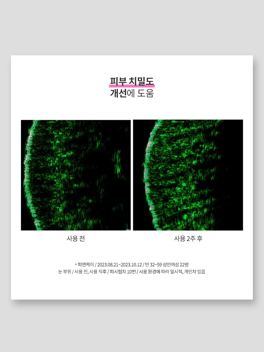 단톤 볼캡 12