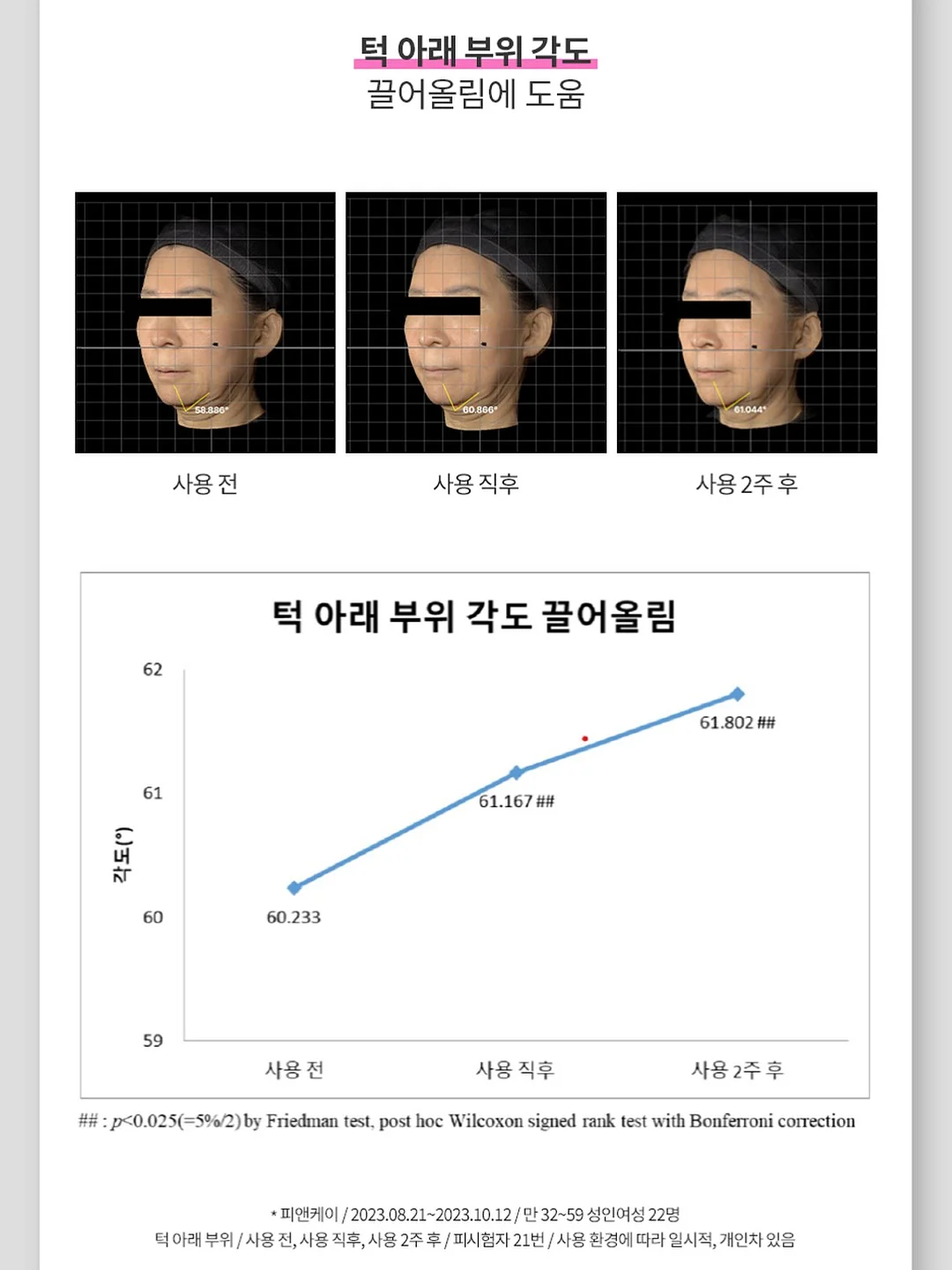 단톤 볼캡 13