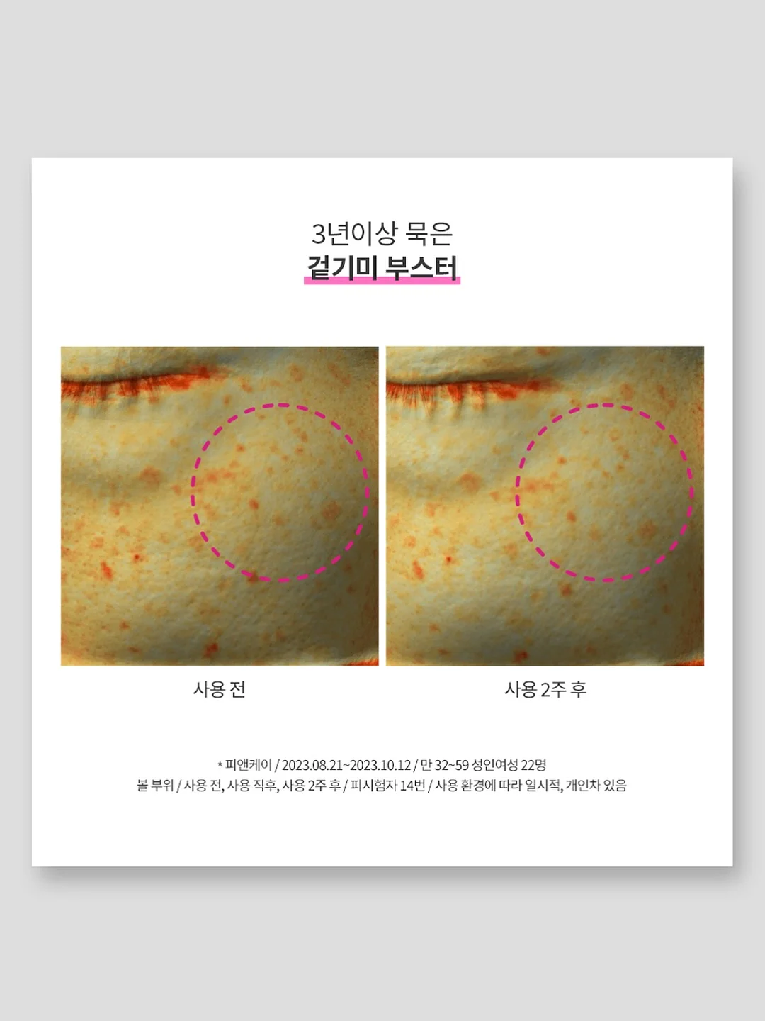 단톤 볼캡 15