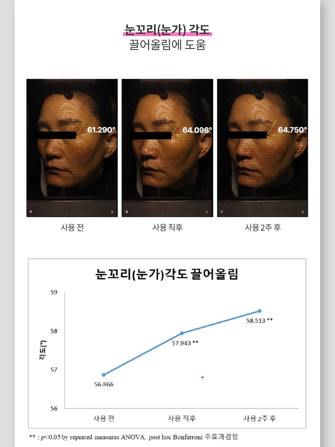 단톤 볼캡 7