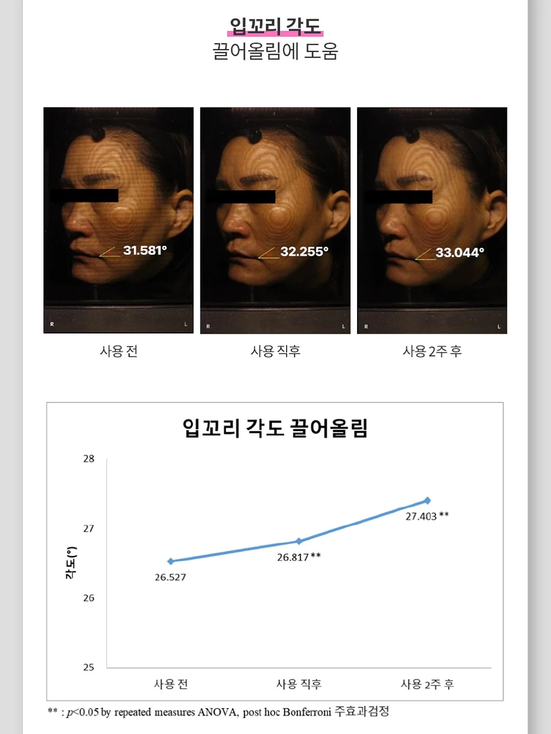 단톤 볼캡 8