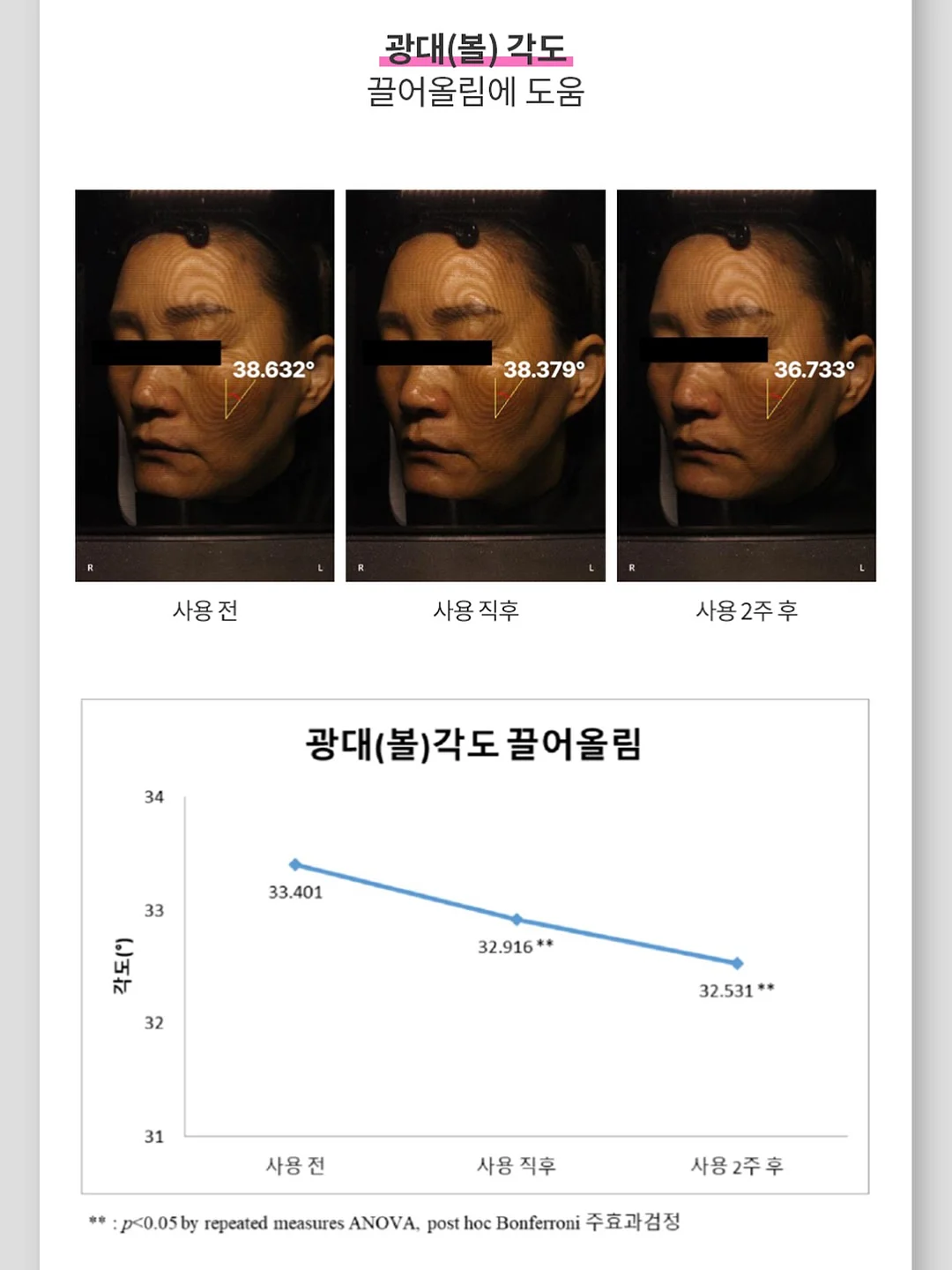 단톤 볼캡 9