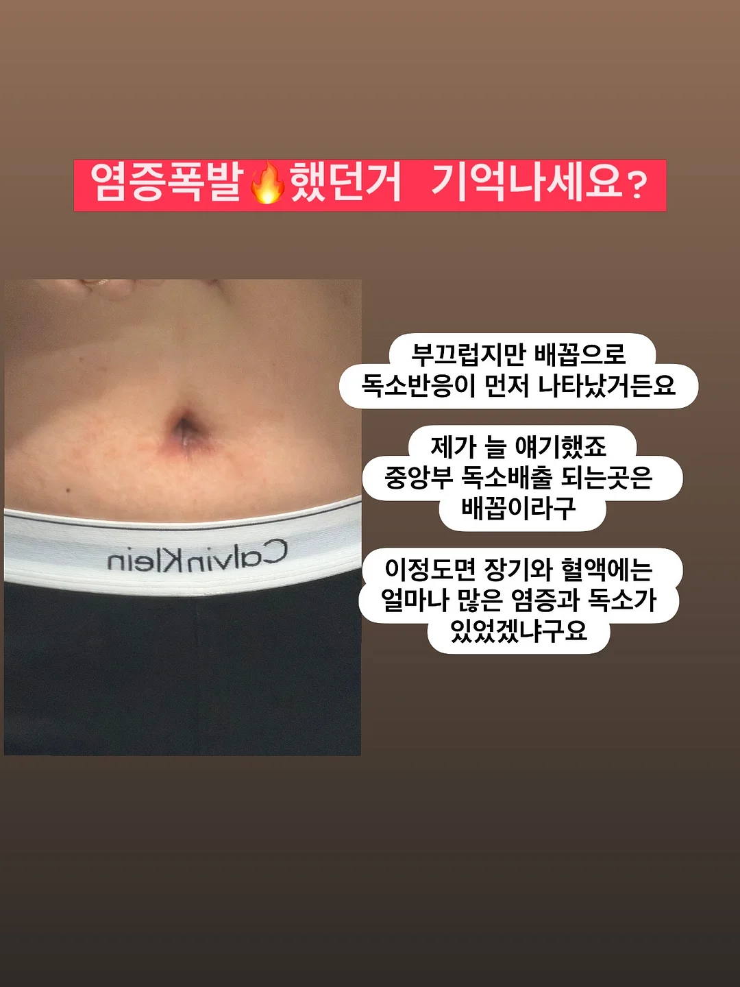 루이비통 1