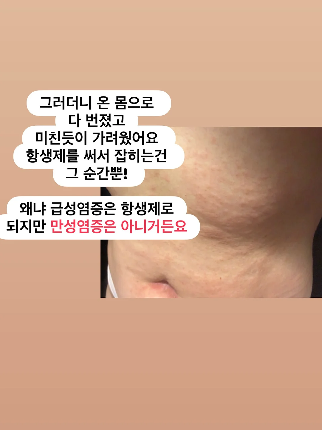 루이비통 2