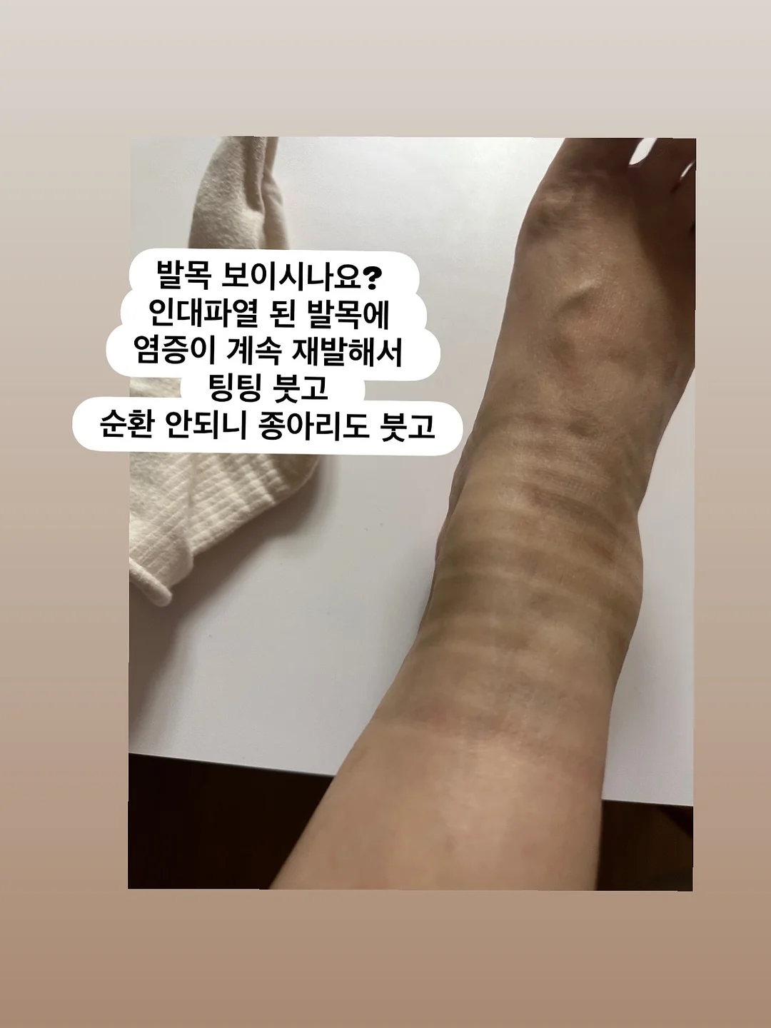 루이비통 5