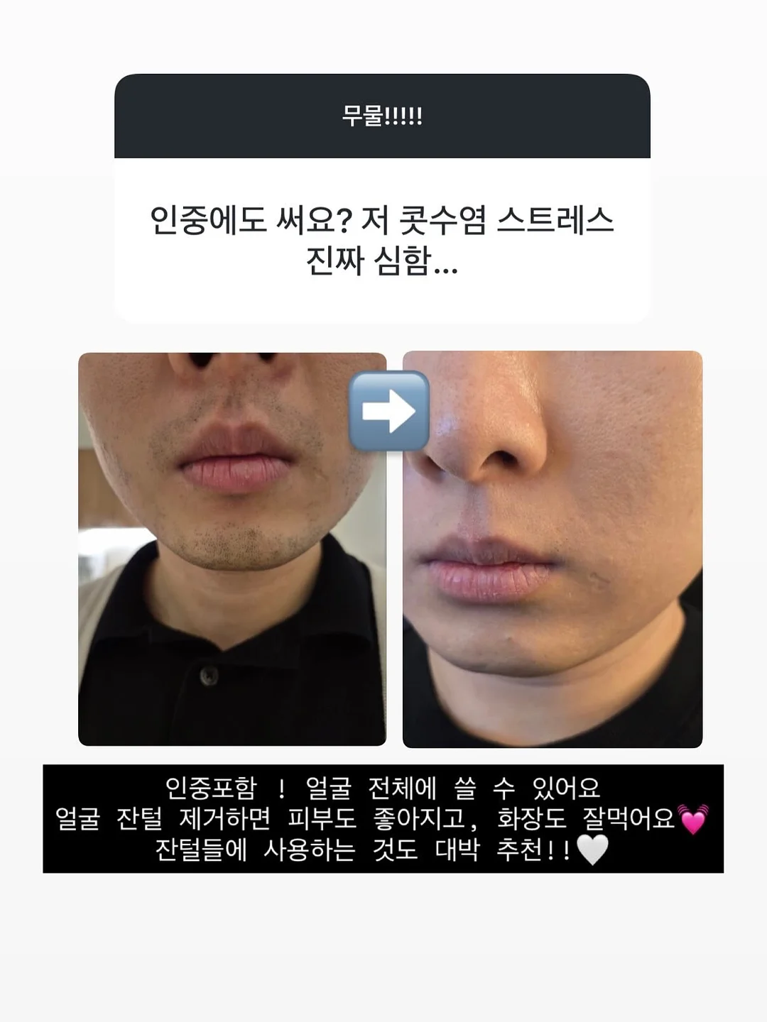 대충쏘야 소스 2