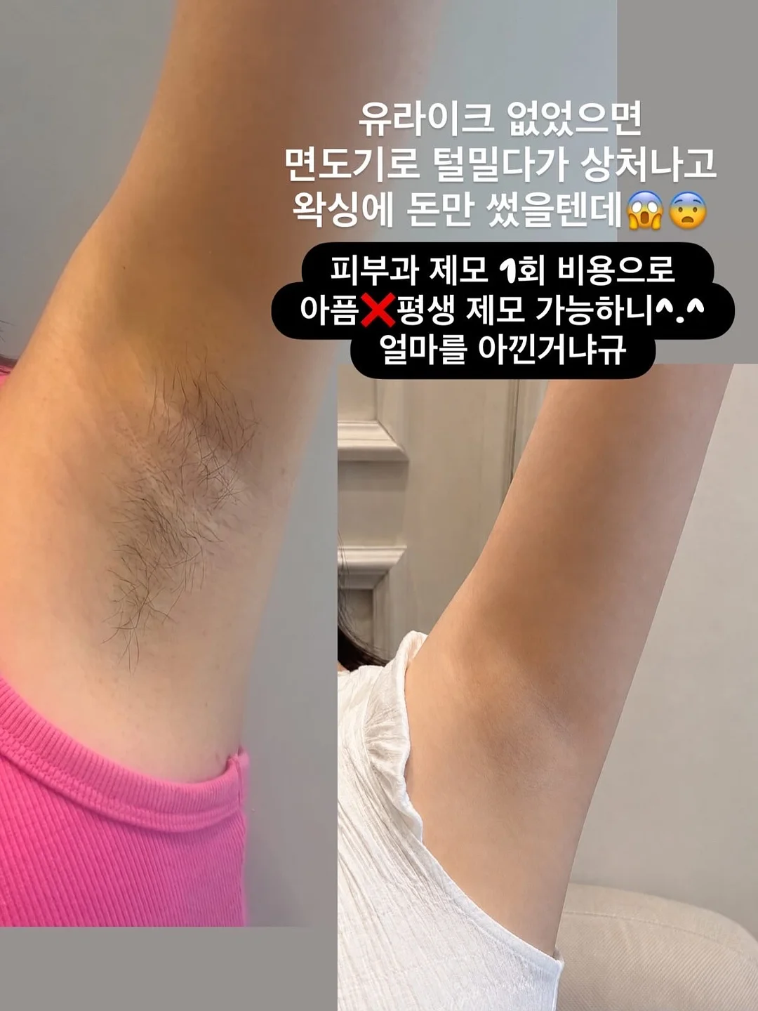 대충쏘야 소스 4