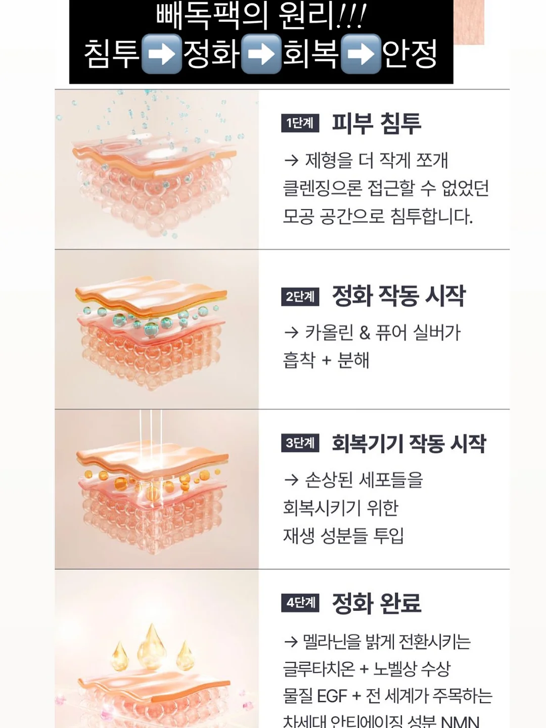 인생 니트 7