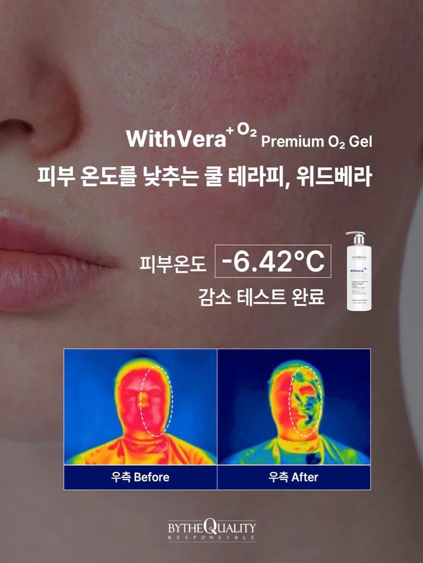 수박 3
