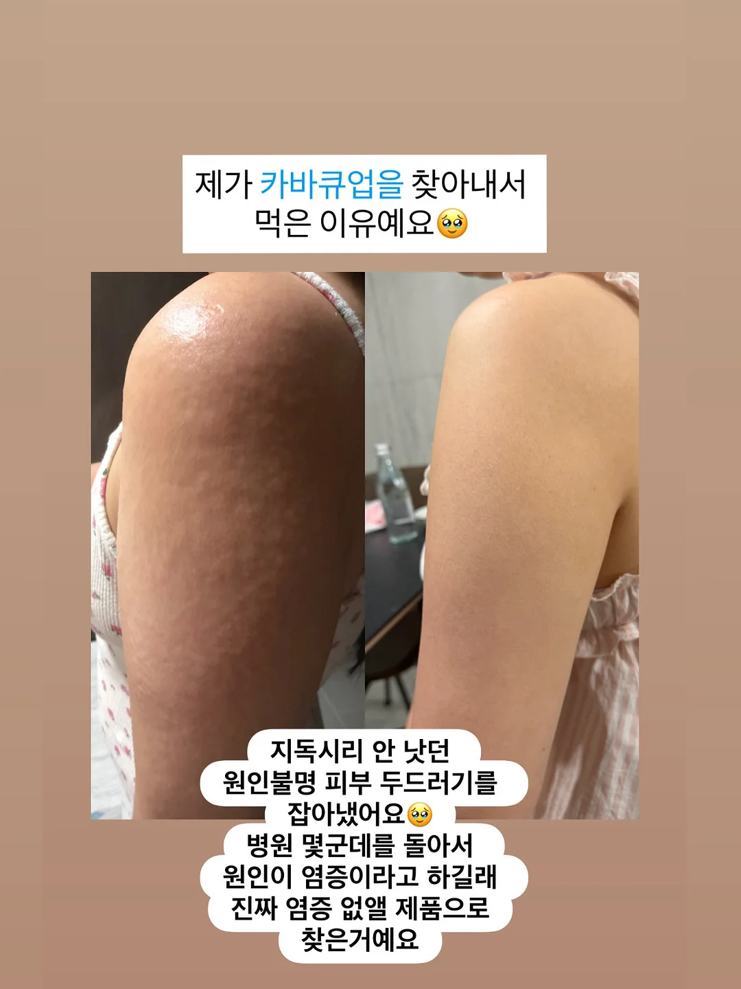흔들리는 날마다 우리는 쉬운 위로를 찾습니다 1
