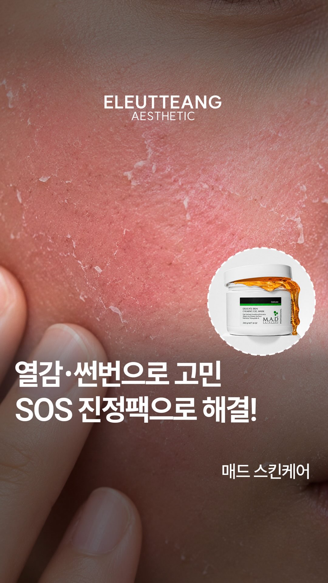 패치 데님 와이드 팬츠