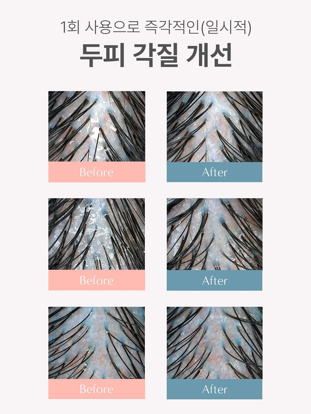 나의 히어로 아카데미아 × 요코하마 핫케이지마 씨 파라다이스 콜라보 굿즈 13