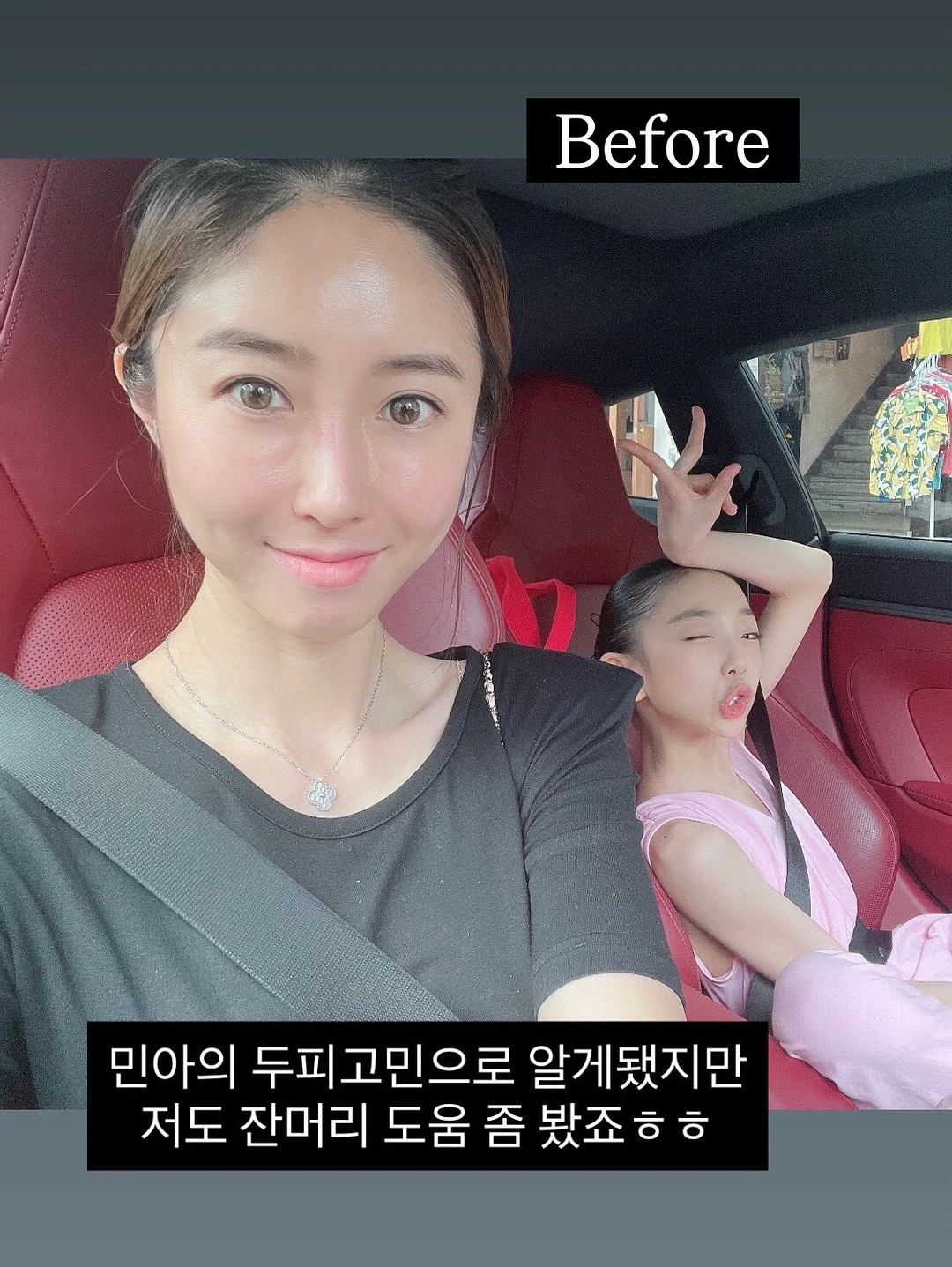바람막이 점퍼 상하 세트 5