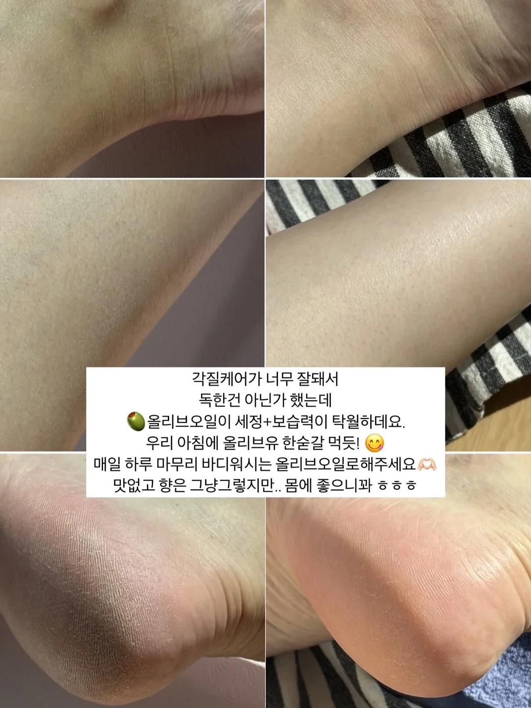 냉동 국산 쭈꾸미 7