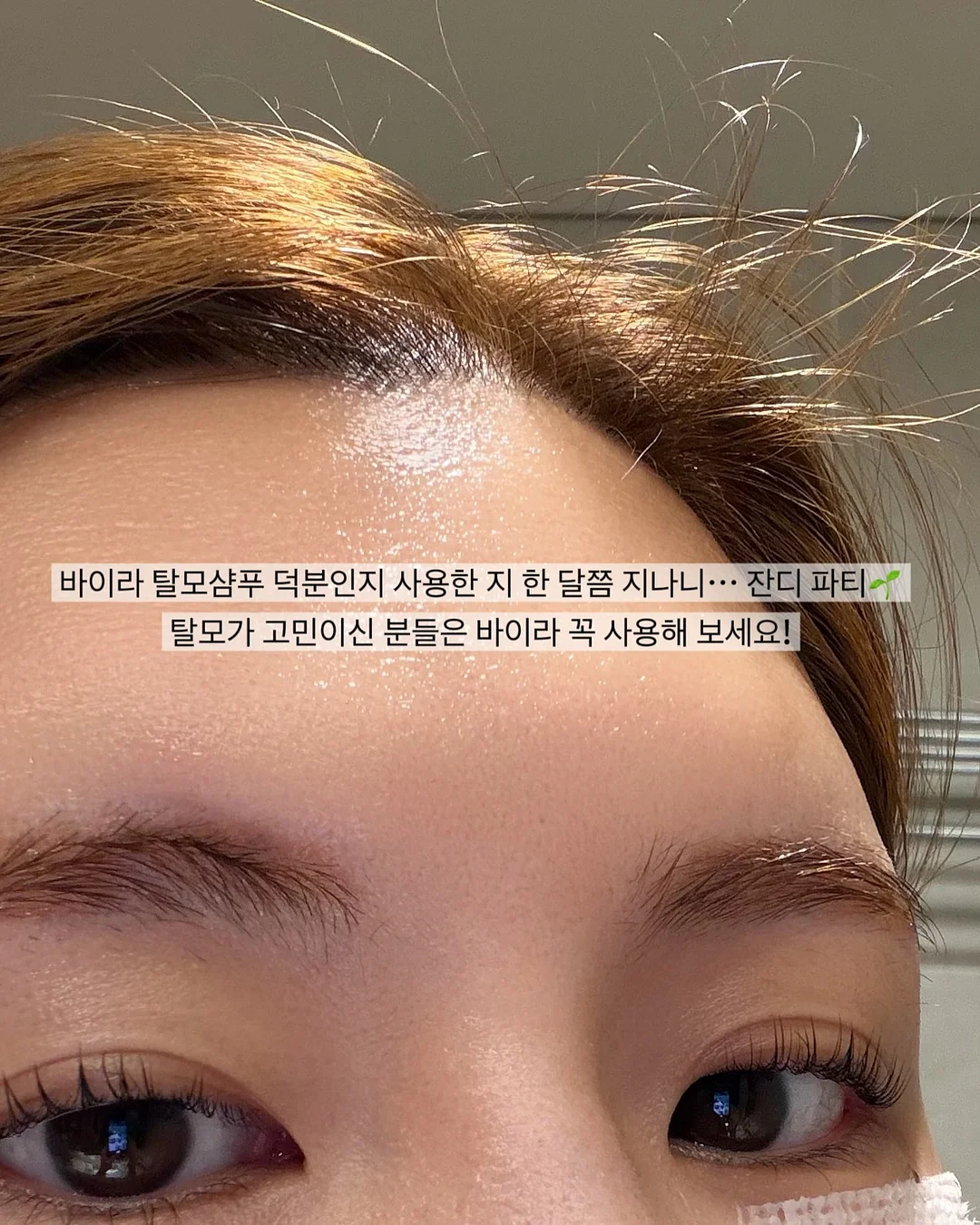아티드 전품목 8