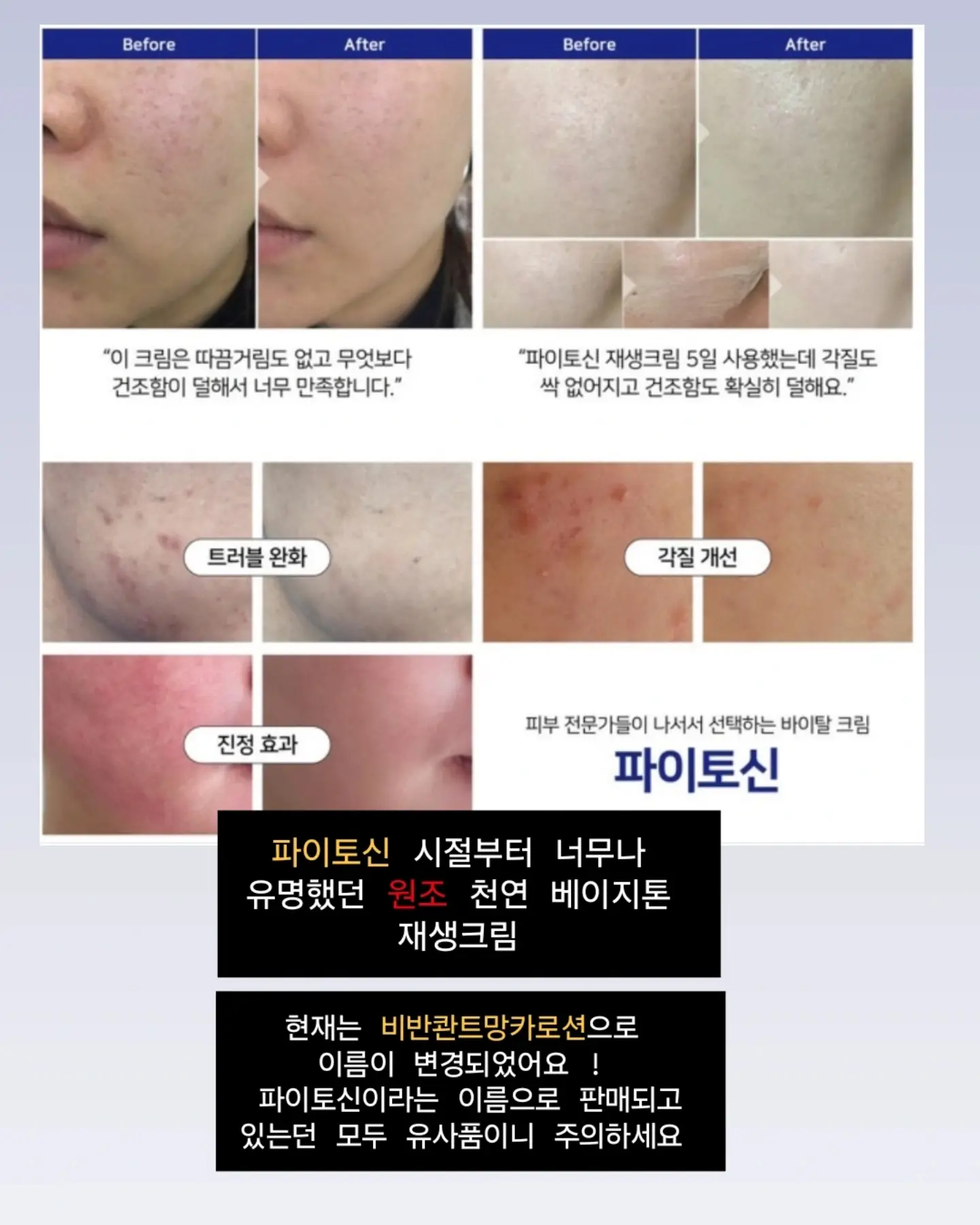 에그 삶는 도구 2