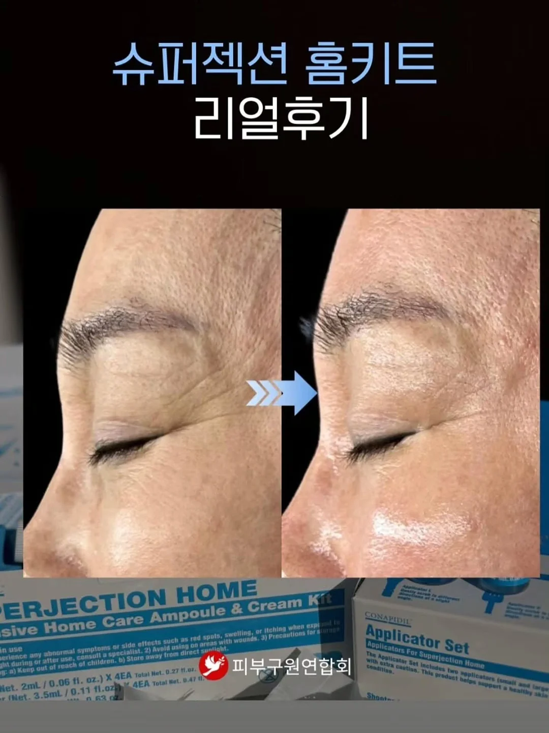 맥스클리닉 멜라토닌 버블 마스크팩 11