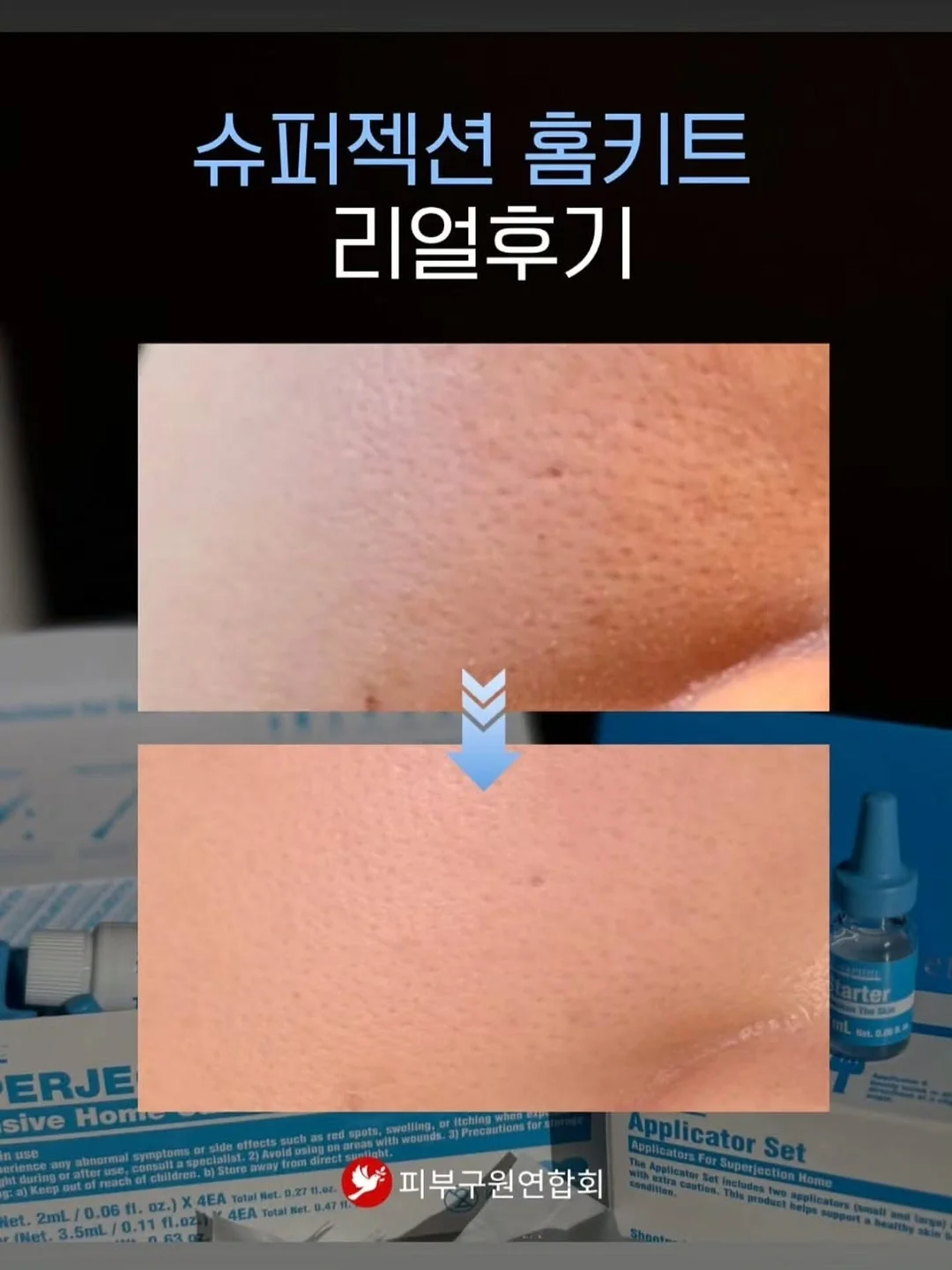 맥스클리닉 멜라토닌 버블 마스크팩 9