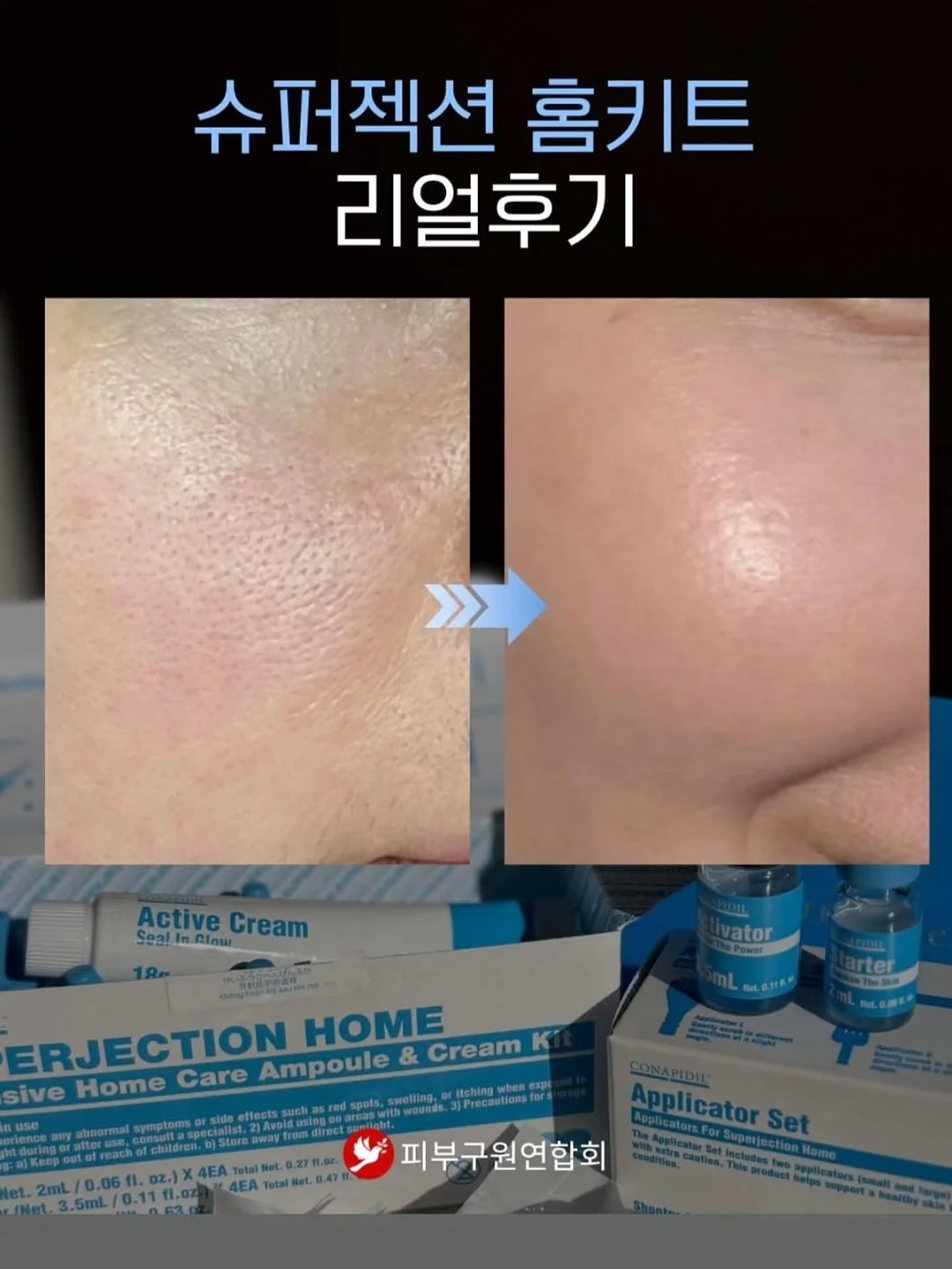 맥스클리닉 멜라토닌 버블 마스크팩 10