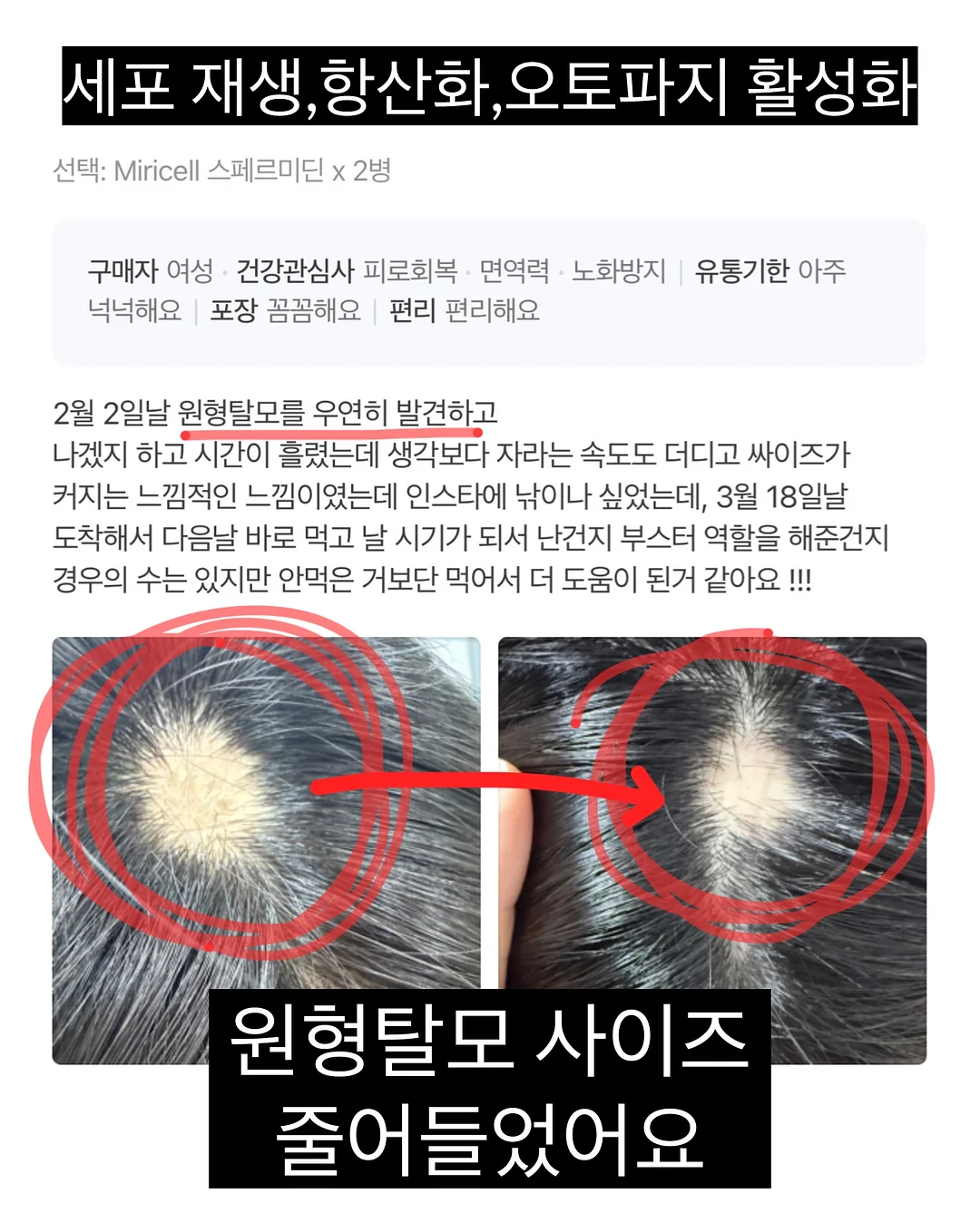 기름 얼룩 제거제 8