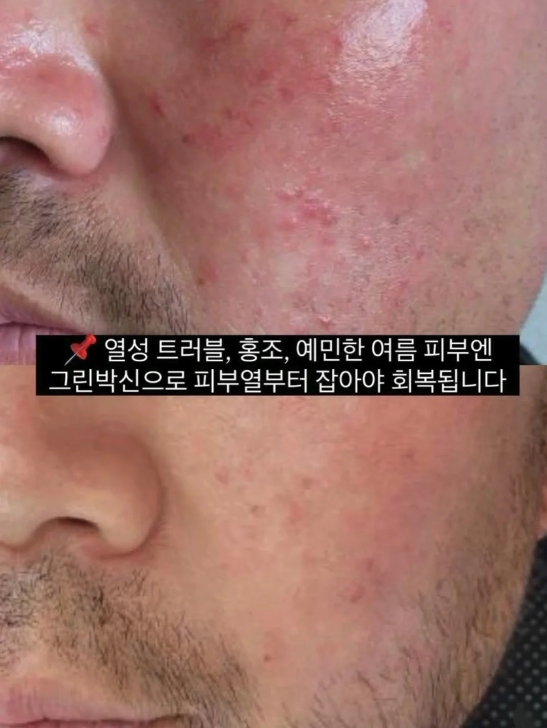 헬렌카민스키 라탄백 7