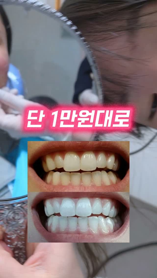 실링왁스